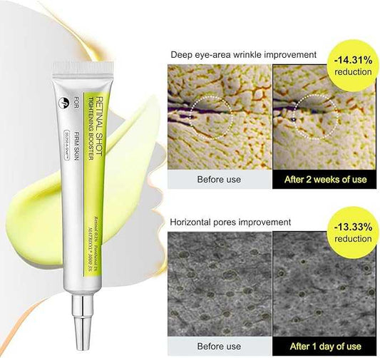 معزز شد البشرة بالريتينال